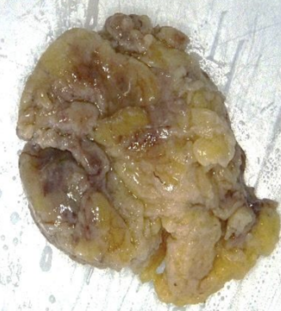 Description of the image